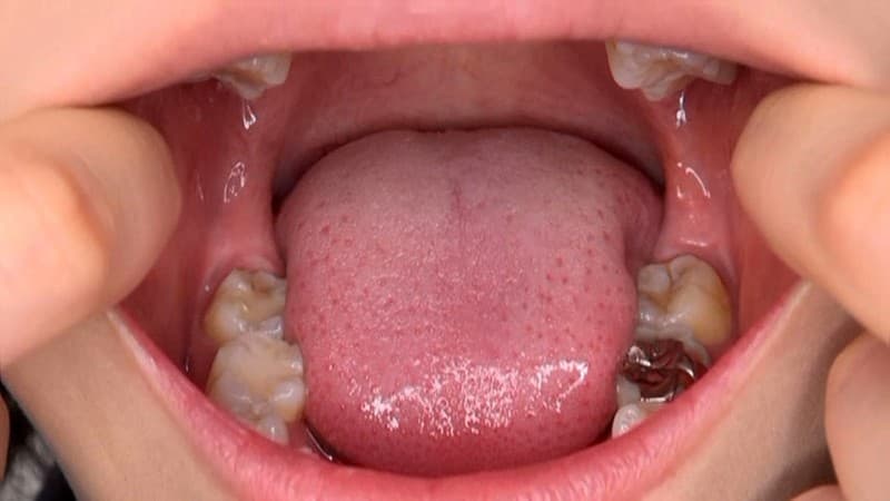 口内丸見え 大口ぱっくんフェラ