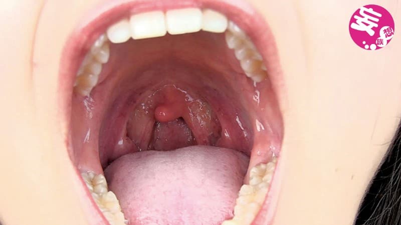 ヴァーチャル口臭嗅ぎ