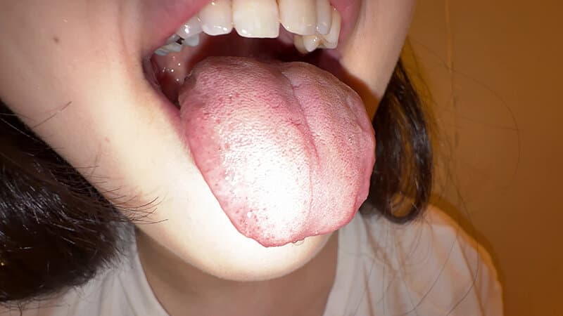 【個人撮影】横山夏希の舌ブラシで「汚舌苔」採取